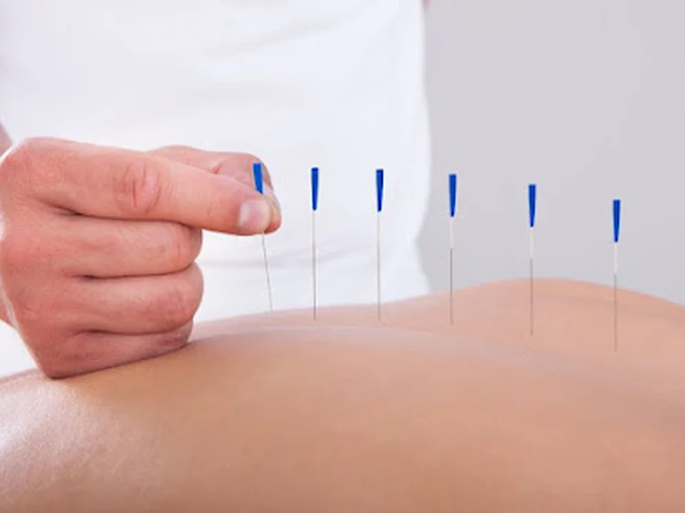 Amsterdamse Acupunctuur