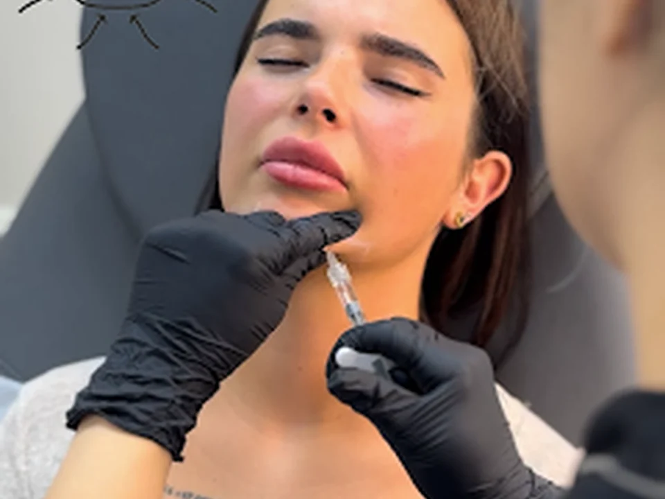 Injection Queen, Amsterdam